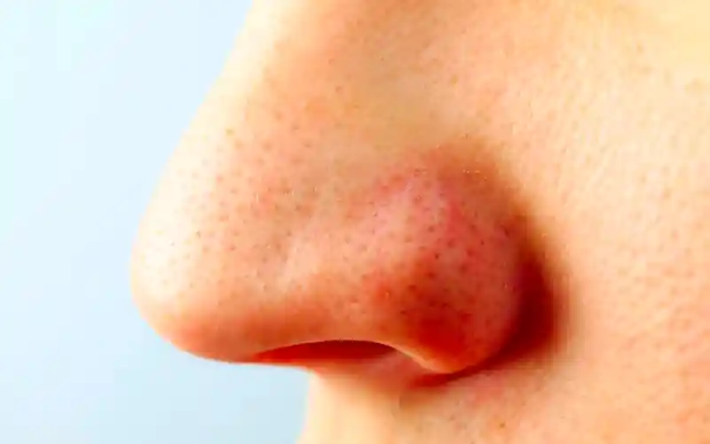 nose