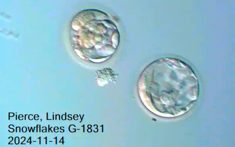 embryo