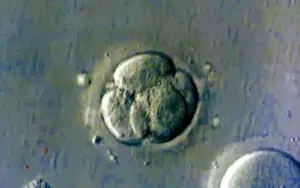 Human eggs