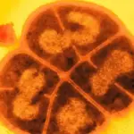 Deinococcus radiodurans